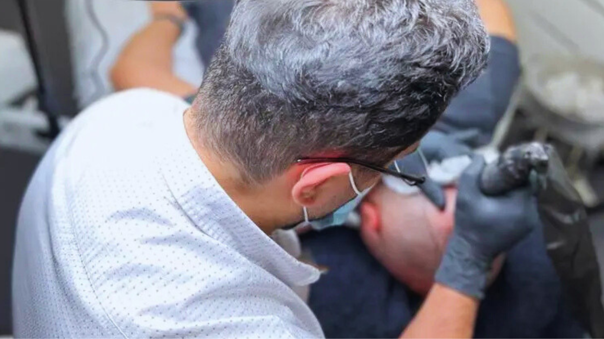 Mikrohaarpigmentierung (SMP) – Die Revolution für kahle Köpfe